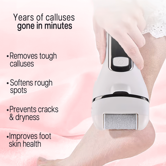 SolSmooth® Callus Remover